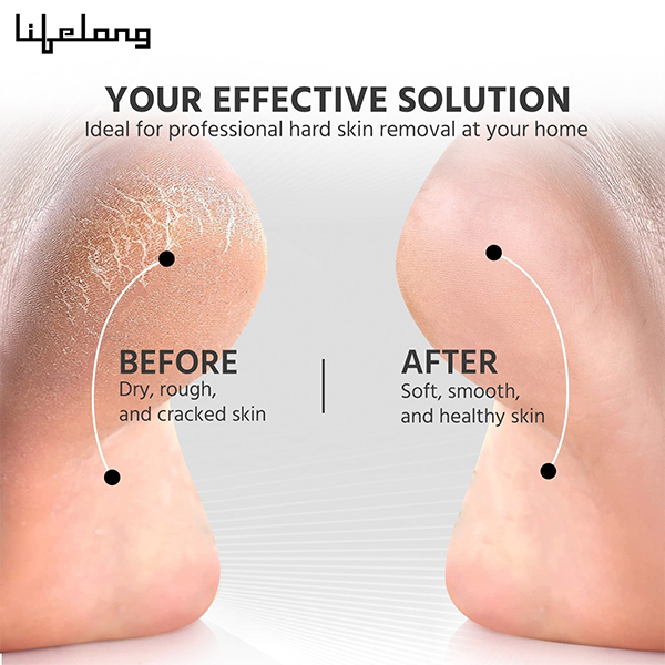 Lifelong LLPCW104 Electric Callus Remover for Feet-4